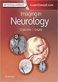 Imaging In Neurology Ebook Pdf Free Download Edited By Osborn And Digre Publisher Elsevier Ebook Format Pdf Size 27 Mb Thi Neurology Ebook Pdf Ebook