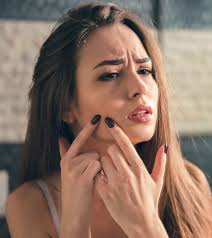 Diet that can control breakouts. How To Get Rid Of A Blind Pimple 10 Remedies Prevention Tips