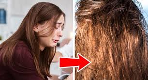What is my hair like after one month? 7 Reasons Why Hair Gets Greasy So Fast And What Can You Do About It
