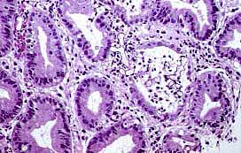 It is a serious fungal infection that affects the sinuses, brain, eyes, lungs and the skin. Index Of Iicvhap Conf 014 Images