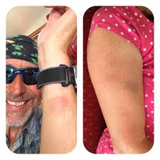 Why Ryan Underhill and I banter about headgear as it is an important  addition to your foul weather gear. An object in motion will stay in  motion, one good smack of