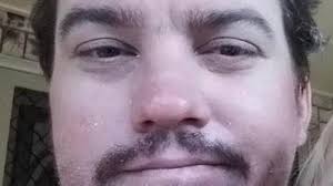 Boaz Herbert John Weis in Gympie court for choking