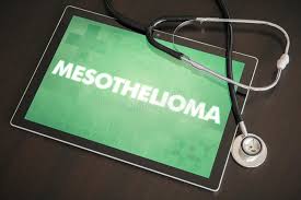 It is recommended for patients suffering from the symptoms of mesothelioma, to consult a cancer specialist for a possible treatment. 251 Mesothelioma Photos Free Royalty Free Stock Photos From Dreamstime