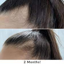 Rich in vitamins a, b1, b2, c, d, and e, kelp has the ability to deliver an abundance of essential nutrients to your hair. Jshealth Vitamins Hair Energy Formula 60 Capsules Bare Skincare And Beauty