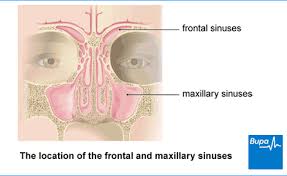 Image result for Sinusitis Prediction Rule