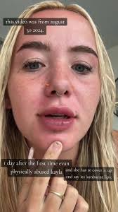 Understanding Domestic Abuse Through Kayla's Story