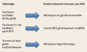 La chirurgie est le principal traitement pour la plupart des cancers de la vessie et peut être pratiquée avant ou après d'autres traitements. Nouvelles Approches Dans Le Traitement Des Tumeurs Non Invasives De La Vessie