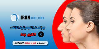 جراحة التجميلية للانف الكبير جدا blog movie posters tours