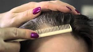 Breakthrough new 'hair cloning' technology could finally consign baldness to history. How To Tell If Hair Follicles Are Alive Hair We Go Youtube