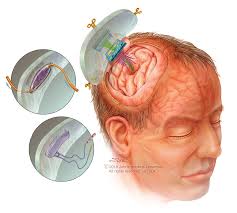 Selected Topics in Neuroplastic & Reconstructive Surgery: