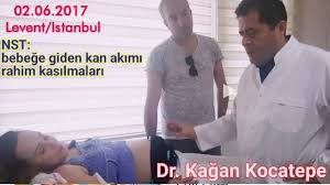 Ayından itibaren doğum anına kadar rahim içerisinde bulunan canlıya nst sancı değeri. Gebelikte Nst Non Stres Test Nedir Nasil Ne Zaman Yapilir 31 4 Haftada Klinigimizden Goruntuler Youtube