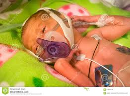 Preemie Baby Girl Sucking On Her Pacifier Stock Photo Image Of Baby Preemie 84053136