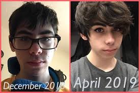 The truth of the matter is, hair growth is determined by a number of factors. 15 Mtf Pre Everything Presenting Male Still Progress Feels Soooo Slow But I Need To Stay Positive And Work Hard On My Skincare Shaving And Hair Growth I Was Lucky Enough To Use