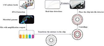 Image result for CSF Culture