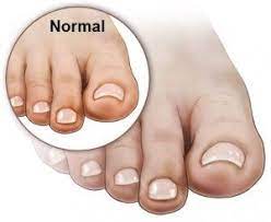 Poor Circulation In Feet Poor Circulation Circulation Poor