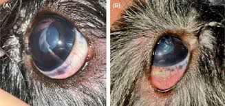 Image result for melanosis sclera