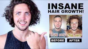 This is mainly why this protein (keratin) is commonly found in some of the most. Awkward Stage Inspiration Insane Hair Growth Time Lapses Youtube
