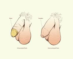 Many translated example sentences containing intimate parts suggest as a translation of intimate parts. Male Anatomy Everything You Need To Know Penis Teen Vogue