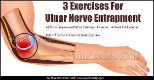 3 Exercises For Ulnar Nerve Entrapment Ulnar Nerve Entrapment Nerve Entrapment Ulnar Nerve