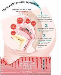 L'endométriose est une maladie de l'endomètre, le revêtement interne de l'utérus : Endometriose En Finir Avec Les Idees Recues