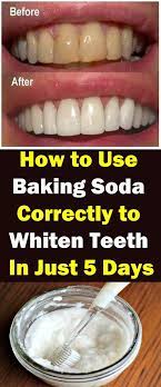 Pin On What Does Oral Care Mean