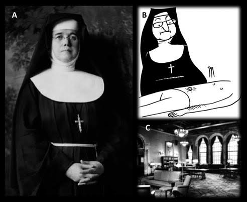 Revisitando a semiologia à beira leito: o nódulo umbilical metastático de  Irmã Maria José – relato de caso Revisiting bed