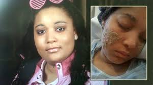 Maybe you would like to learn more about one of these? Woman S Hair Turns To Black Fingernails Baffling Her Doctors Abc News