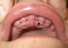 We did not find results for: Alveolar Osteitis Wikipedia
