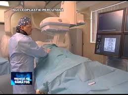 Cat costa interventia si care este criteriul de selectie al pacientilor. Nucleoplastia Percutana A Herniei De Disc Youtube