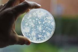 Phytovista laboratories food testing service helps you eliminate contamination risk factors in your food products. Food Feed Testing Eurofins Scientific