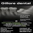 Wisdom tooth surgery product image