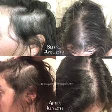 Haircovery Hair Serum Results Hair Serum Hair Thickening Serum Curly Hair Serum