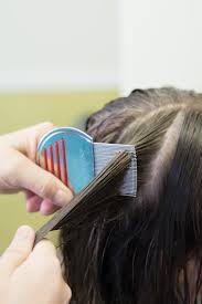 Those of african american descent tend to have an oval profile. 5 Common Myths Associated With Head Lice