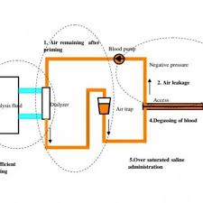 Fresenius manufacturer specifications for 2008t hemodialysis machine on medwow medical equipment global marketplace. By Unknown Case Get Electronics Biomedical Engineering