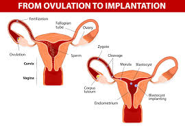 Image result for corpus luteum sonography)