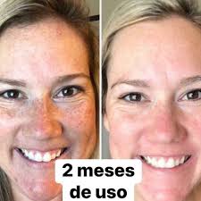 For more information,,Inbox me..