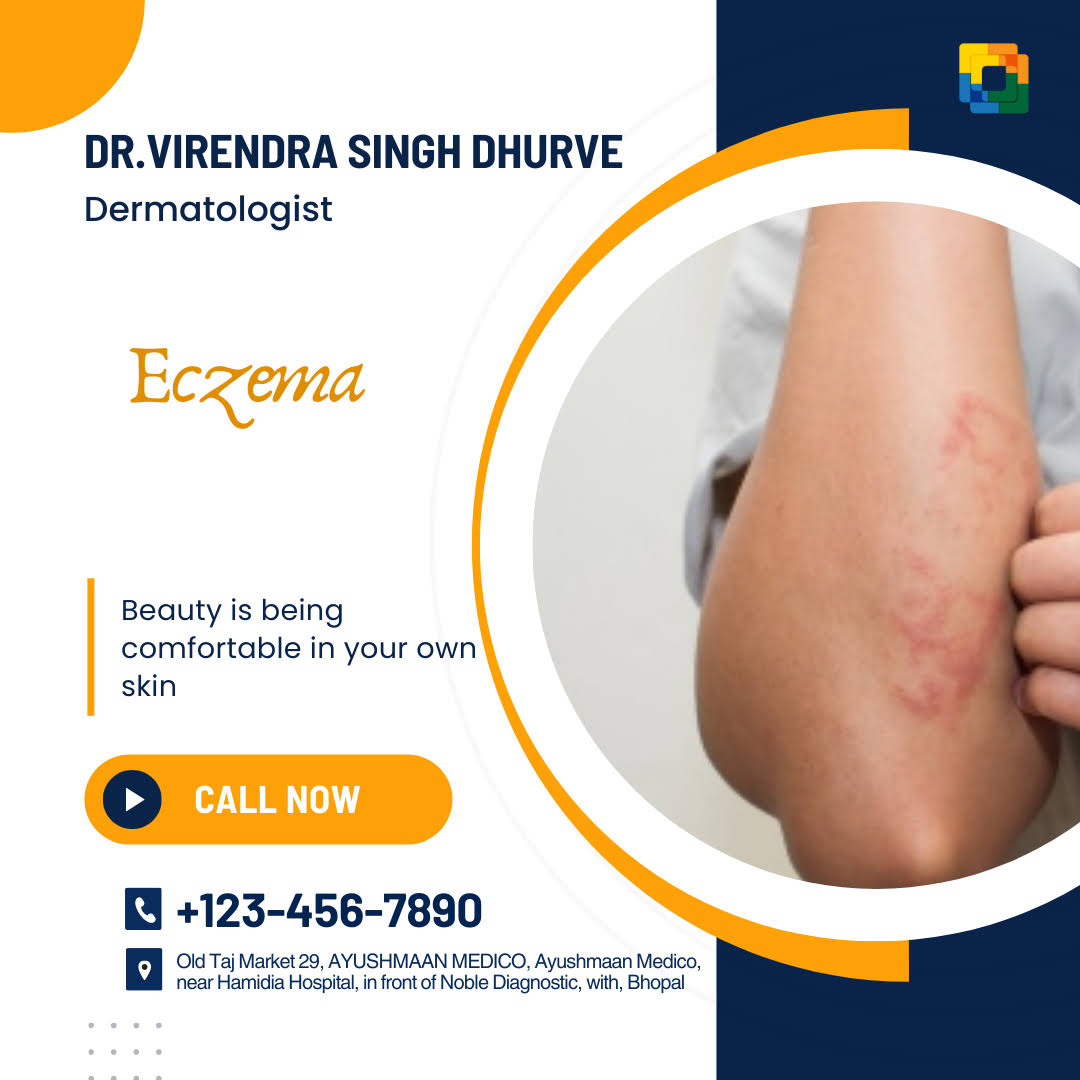 Eczema product image