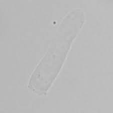 Image result for Urinary Cast