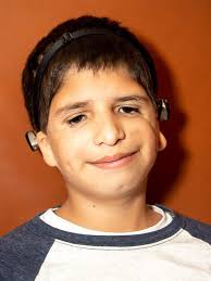 Max's Journey with Treacher Collins Syndrome