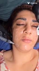 د.رامي عودة