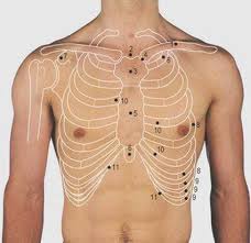 Basic rib anatomy consists of a head, neck, tubercle. Thorax Surface Anatomy 4 Edition