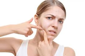 Understanding Acne Vulgaris: Causes, Symptoms & Treatments