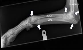 Image result for Growth Plate