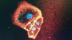 Virus gripal tip a subtip h1n2. IncÄƒ Un Virus Gripal A ApÄƒrut In Sua InformaÈ›ii De UltimÄƒ OrÄƒ Primele Cazuri Impact