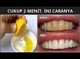 7 Cara Memutihkan Gigi Dalam 2 Menit Terbukti Ampuh Pemutih Gigi Kesehatan Pemutih