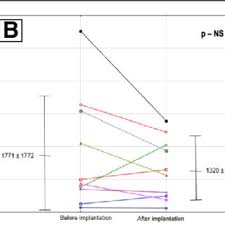 Die pumpe arbeitet sozusagen gegen den erhöhten strömungswiderstand an, der durch das schließen der thermostatventile verursacht wird. Photography Of The Lenus Pro Pump Prepared For Implantation Download Scientific Diagram