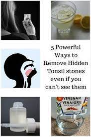 Pin On Sinus