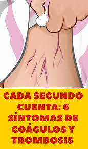 Aunque no todos los que desarrollan una tvp tienen síntomas, hay varios signos característicos de un coágulo de sangre en una de las venas profundas en sus piernas. Cada Segundo Cuenta 6 Sintomas De Coagulos Y Trombosis Trombosis Consejos Para La Salud Coagulos