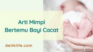 Check spelling or type a new query. Arti Mimpi Menggendong Bayi Cacat Detiklife