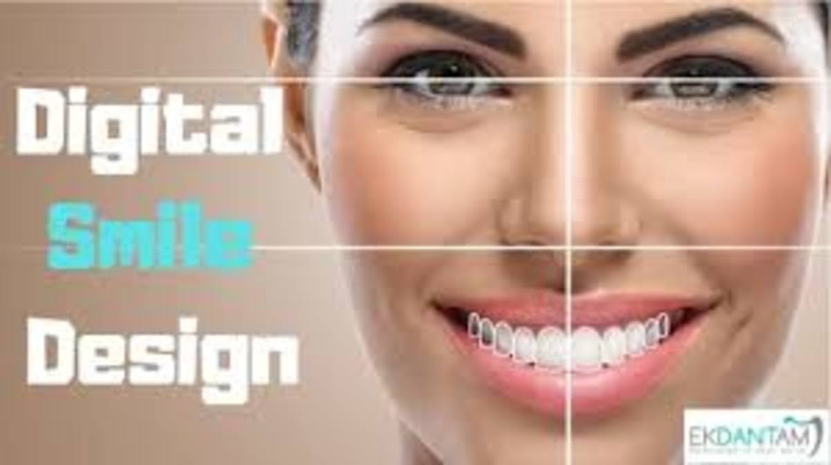Cosmetic Smile Designing product image